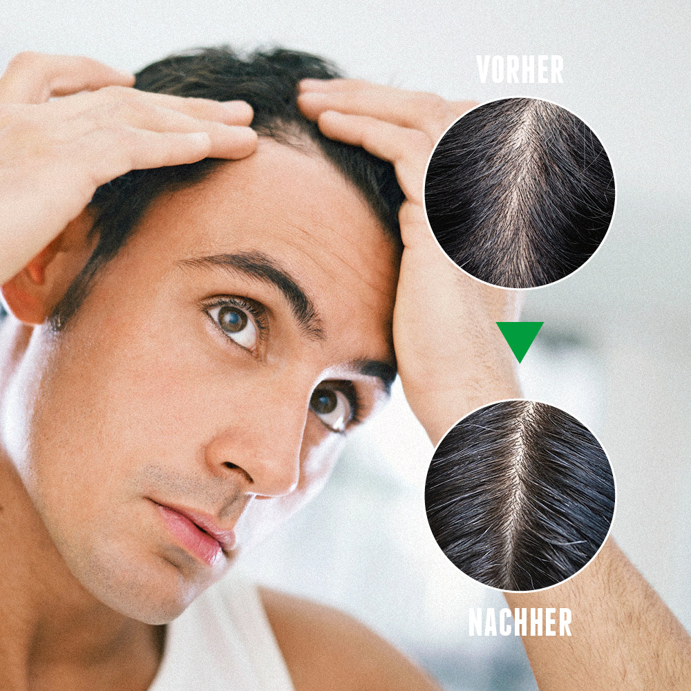 Das Activator Hair Shampoo für Männer liefert sichtbare Ergebnisse und reduziert Haarausfall bei Männern. 